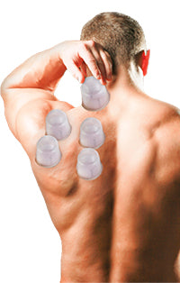 Celluvac Cupping Cups Suctioned on Mans Left Shoulder